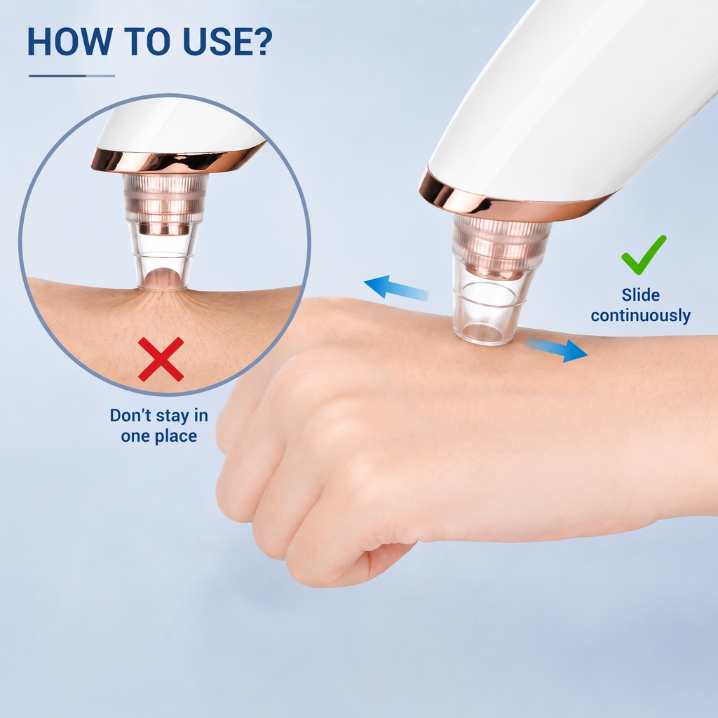 5-in-1 Blackhead Remover Vacuum