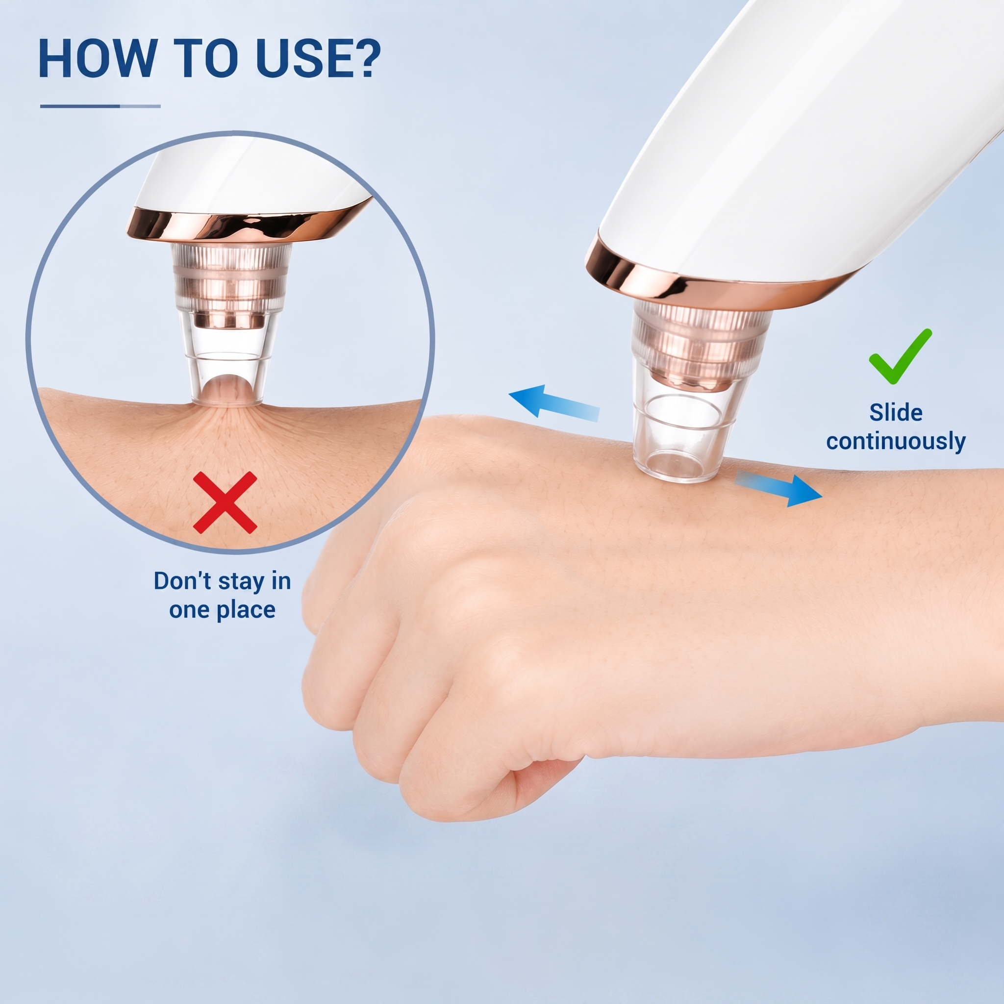 5-in-1 Blackhead Remover Vacuum